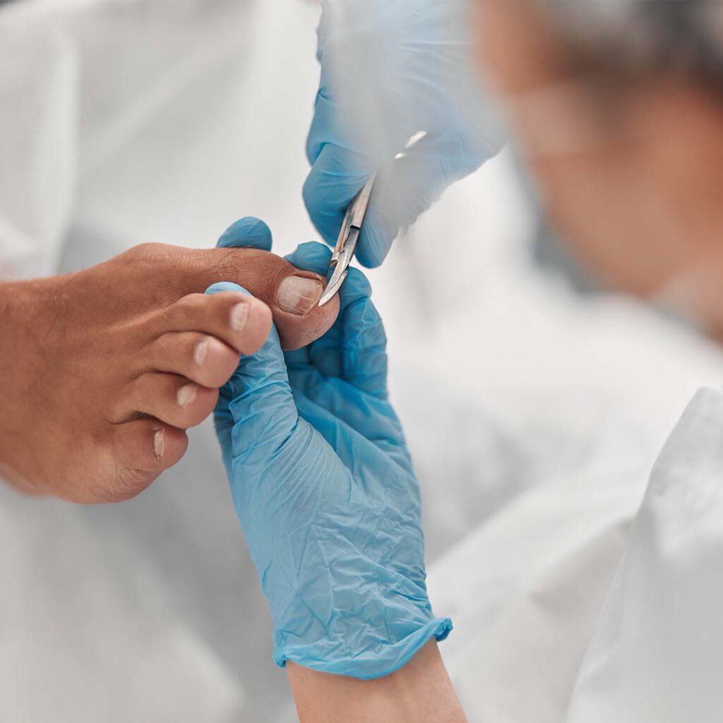 פדיקור רפואי - נטלי קוסמטיקס