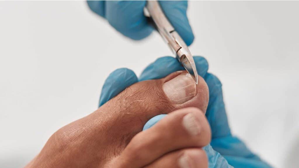 טיפול פדיקור רפואי לגיל הזהב