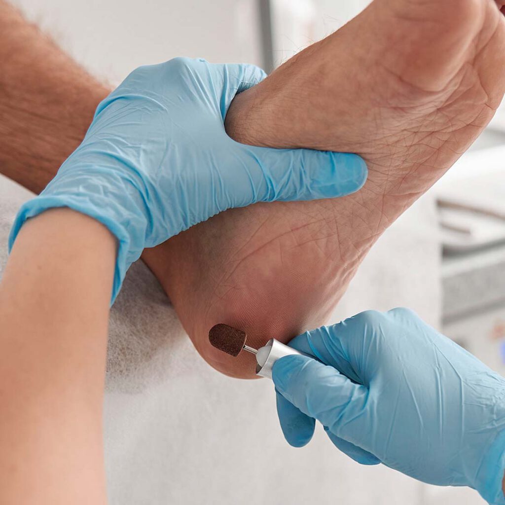 פדיקור רפואי