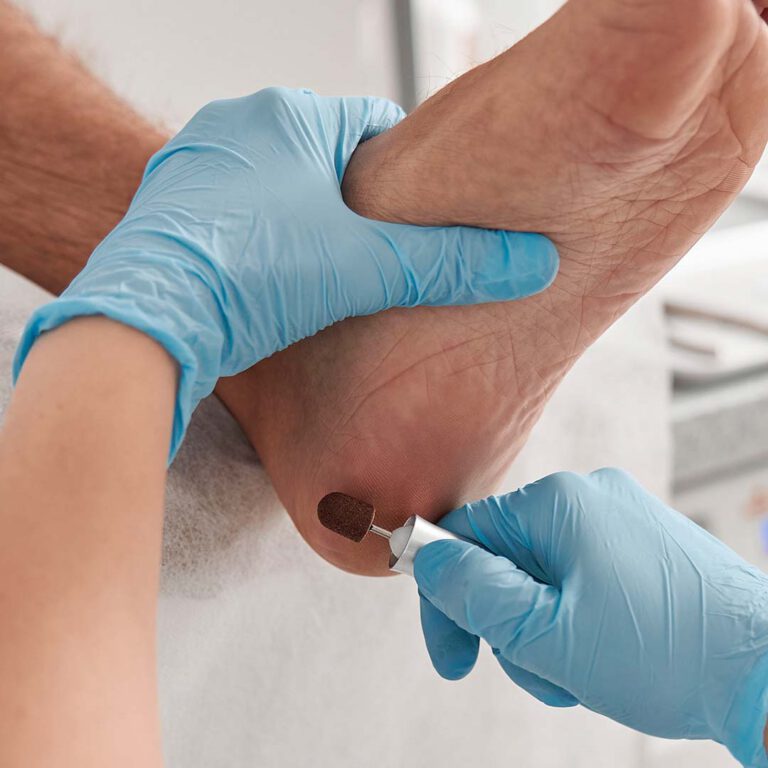 פדיקור רפואי