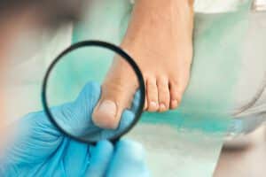 המון אנשים חווים את אי הנוחות של ציפורן חודרנית בשלב מסוים בחייהם. כיום ניתן לראות שבין 15-20 אחוז מכלל האוכלוסיה סובלים מציפורן חודרנית כלומר 1 מכל 5 אנשים. יש לזה כמה סיבות, ראשית זה נוצר כתוצאה של חיתוך לא נכון של הציפורניים, נעליים צמודות שמשפיעות על מבנה הציפורניים וגורמות ללחץ או נטייה גנטית, כאב של ציפורן חודרנית השכיח הזה יכול להיות יותר מסתם מטרד קל. במאמר זה, נעמיק בחשיבות של פנייה לעזרה מקצועית בעת התמודדות עם ציפורניים חודרניות, ונבדוק את הסימנים והתסמינים שצריכים לתת לנו את ההתראה לבדוק את הציפורן חודרנית.