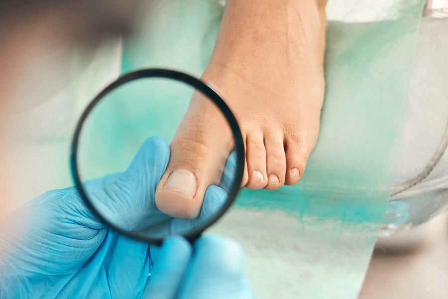 המון אנשים חווים את אי הנוחות של ציפורן חודרנית בשלב מסוים בחייהם. כיום ניתן לראות שבין 15-20 אחוז מכלל האוכלוסיה סובלים מציפורן חודרנית כלומר 1 מכל 5 אנשים. יש לזה כמה סיבות, ראשית זה נוצר כתוצאה של חיתוך לא נכון של הציפורניים, נעליים צמודות שמשפיעות על מבנה הציפורניים וגורמות ללחץ או נטייה גנטית, כאב של ציפורן חודרנית השכיח הזה יכול להיות יותר מסתם מטרד קל. במאמר זה, נעמיק בחשיבות של פנייה לעזרה מקצועית בעת התמודדות עם ציפורניים חודרניות, ונבדוק את הסימנים והתסמינים שצריכים לתת לנו את ההתראה לבדוק את הציפורן חודרנית.