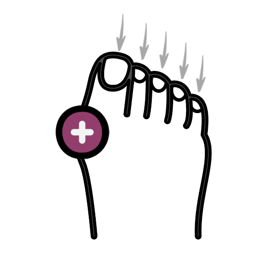 טיפול בפטרת ציפורניים