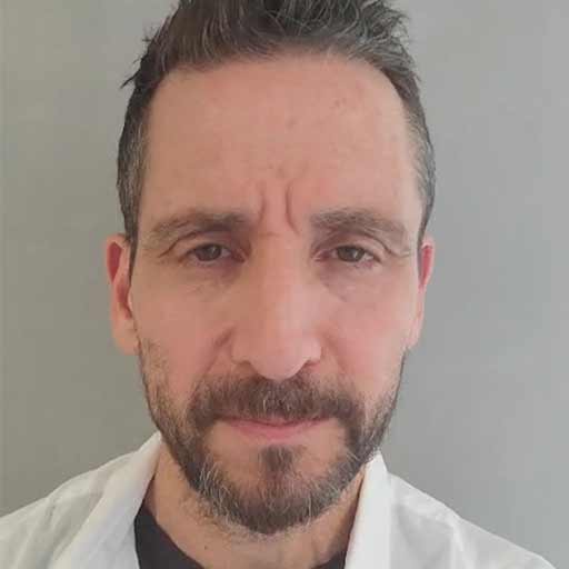 אביב זמיר הגיע לטיפול פדיקור רפואי, עקב בעיה של יבלות בכף הרגל בואו לראות מה הוא מספר על התוצאות לאחר הטיפול