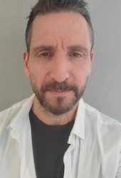 אביב זמיר הגיע לטיפול פדיקור רפואי, עקב בעיה של יבלות בכף הרגל בואו לראות מה הוא מספר על התוצאות לאחר הטיפול