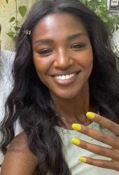 טיטי דוגמנית -"הוכתרה בעבר כ-מלכת היופי של ישראל"👑 תראו מה היא מספרת על הטיפול שהיא קיבלה ב-"נטלי קוסמטיקס"